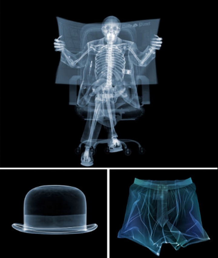 x-ray-fotografía-1