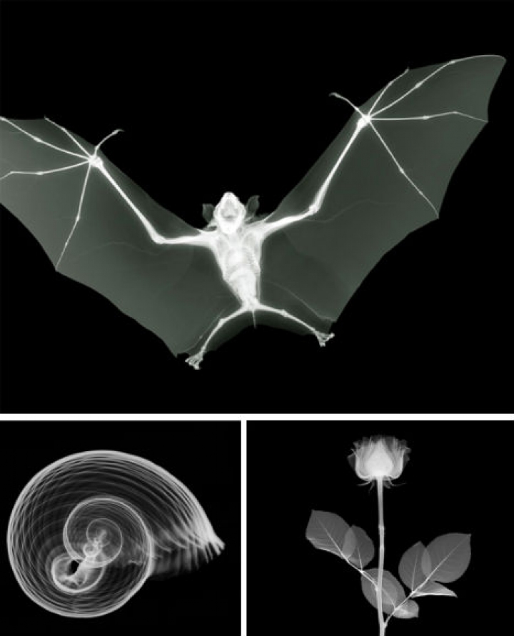 x-ray photographie-3