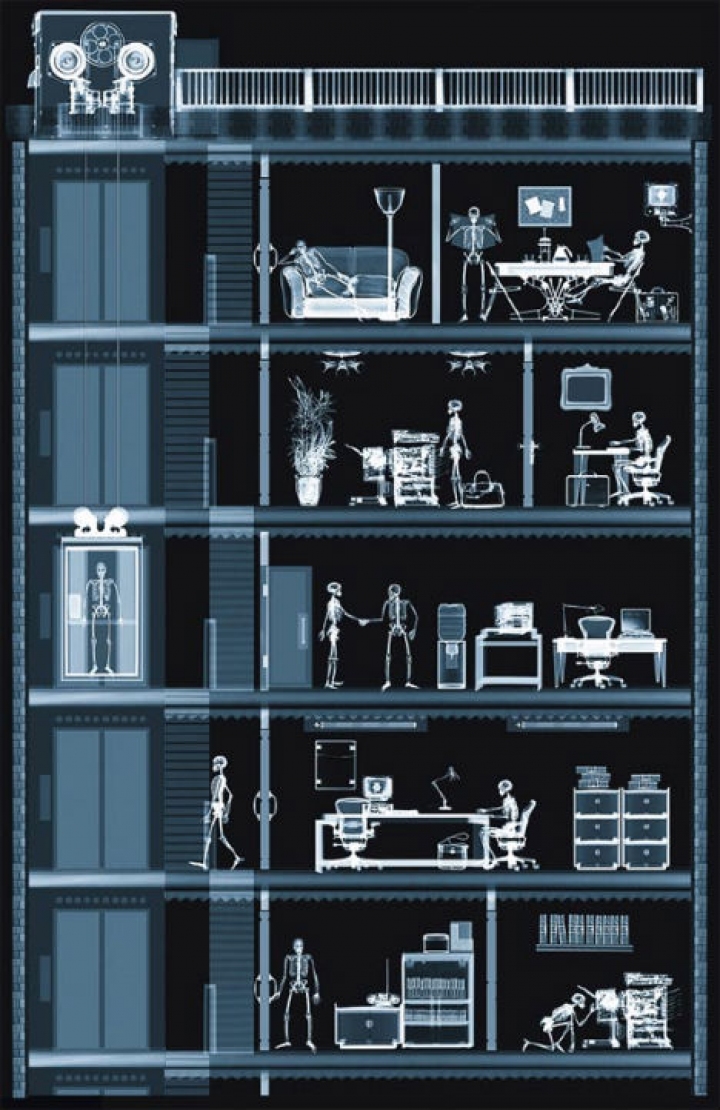 x-ray-fotografi-4